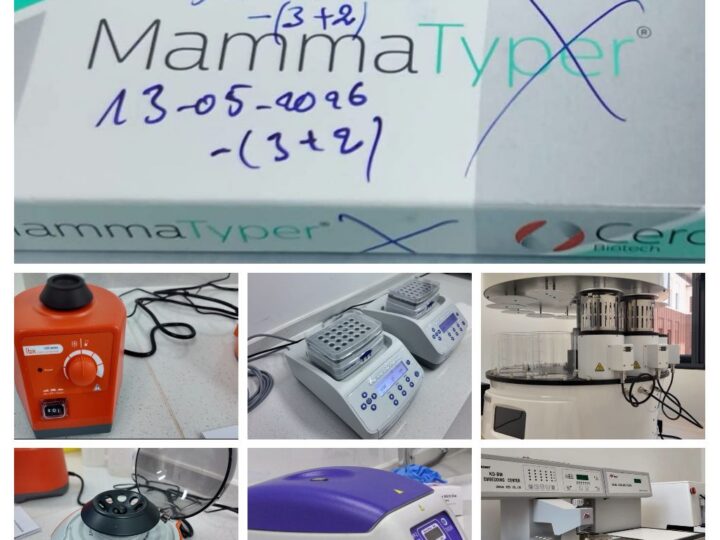 Cancer du sein : le diagnostic moléculaire par la «MammaTyper », désormais disponible au Burkina Faso